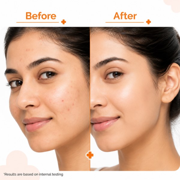 Pore Minimizing Sunscreen Gel with SPF 50 & PA+++ For Open Pores & UVA/UVB Protection | 50 g - Image 4