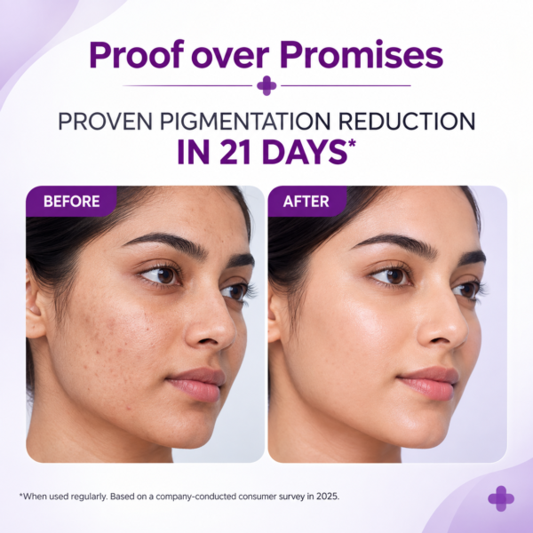 2% Kojic Acid Face Serum for Dark Spots & Pigmentation | 30ml - Image 5