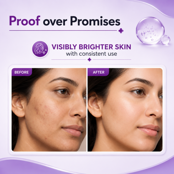 15% Vitamin C Face Serum for Skin Radiance & Brightening | 30ml - Image 4